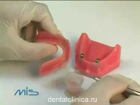 Стоматология лечение зубов hi-tech MIS имплантация в Москве Санкт-Петербурге европейское качество
