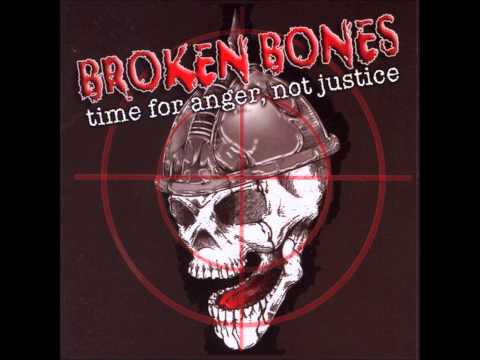 Broken Bones - Dead Inside
