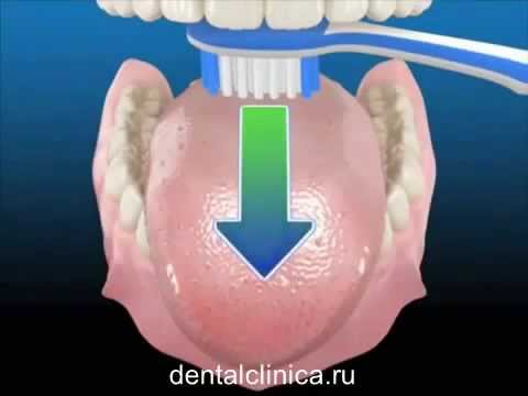Стоматология лечение зубов имплантация протезирование в Москве Санкт-Петербурге европейское качество