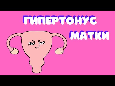 Др. Елена Березовская - О "гипертонусе" матки
