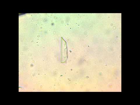 Жидкое мыло под микроскопом 2000x 10 01 1014
