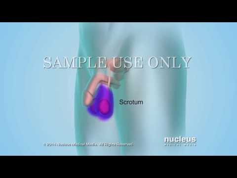 Health Literacy Video: Sperm Count